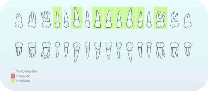 Ficha de Anamnese Odontológica: Entenda como fazer de forma bem fácil