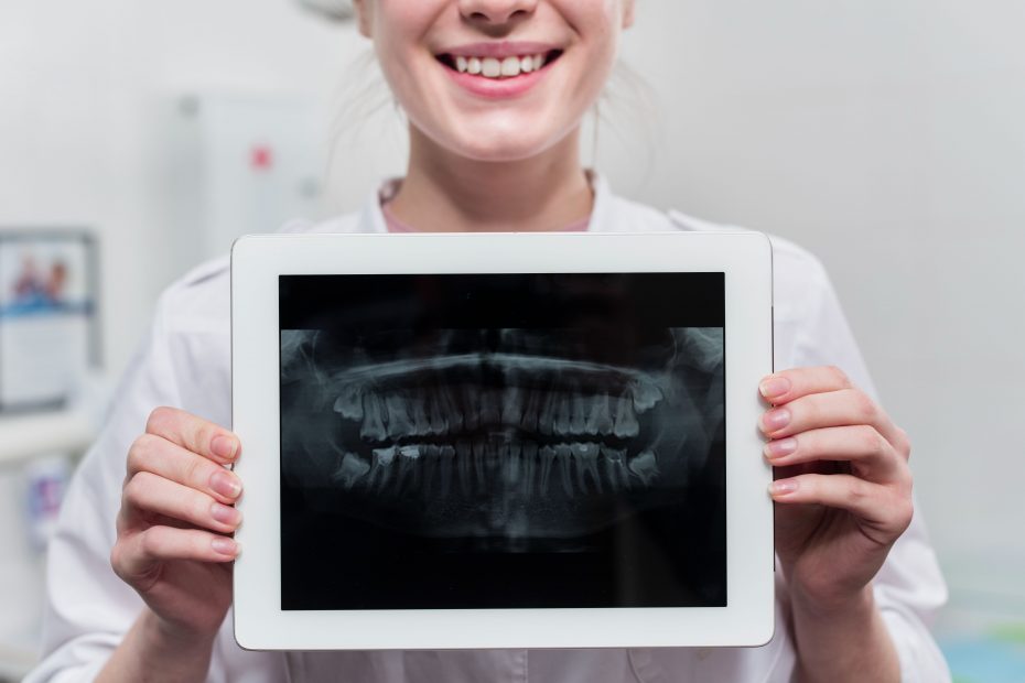 Radiologia odontológica: visão geral, benefícios e resultados esperados na sua clínica